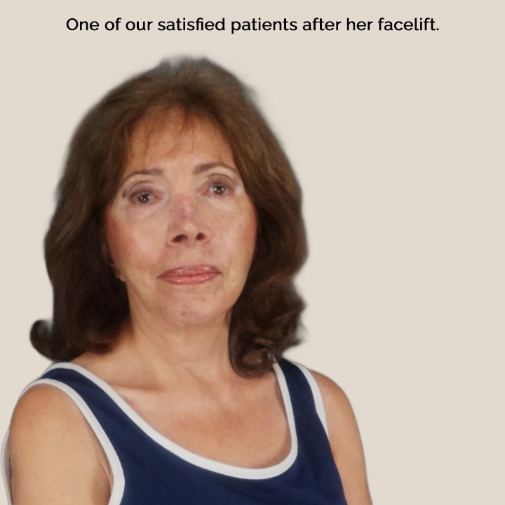 satisfied patient after her facelift