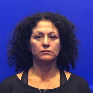 Middle-aged woman facelift natural beautiful results hidden scars – Dr. Elkowitz Great Neck New York City Plastic Surgery of New York preoperative before and after photo – pre op front