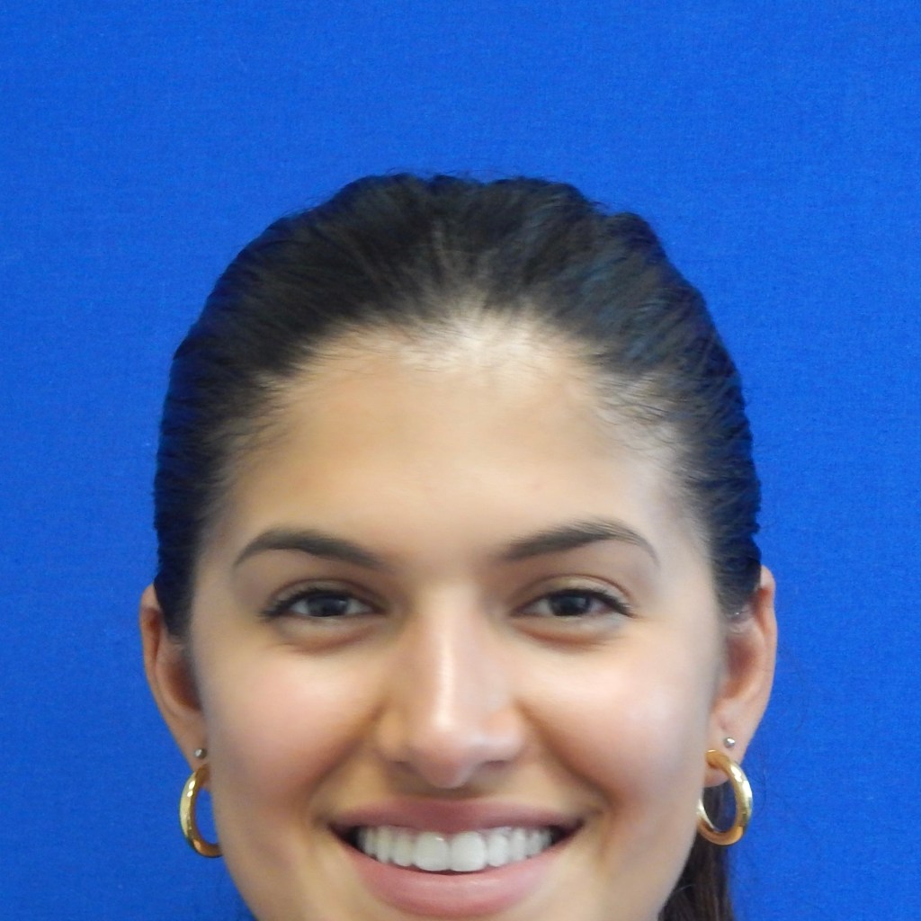 nose job, rhinoplasty, nasal dorsum, bump, nasal tip