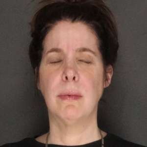 natural, refreshed results for the face, eyes, and neck facelift neck lift