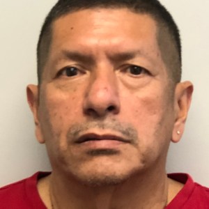 Middle-aged man upper and lower eyelid blepharoplasty natural rejuvenation results – Plastic Surgery of New York – pre op zoom in front