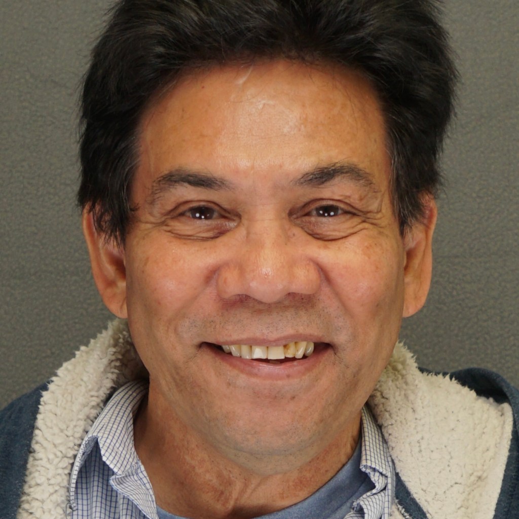 50 year old Asian man rhinoplasty nasal base reduction weir excision before photo - Dr. Elkowitz Great Neck NY – pre op front zoom in
