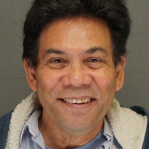 50 year old Asian man rhinoplasty nasal base reduction weir excision before photo - Dr. Elkowitz Great Neck NY – pre op front zoom in smile