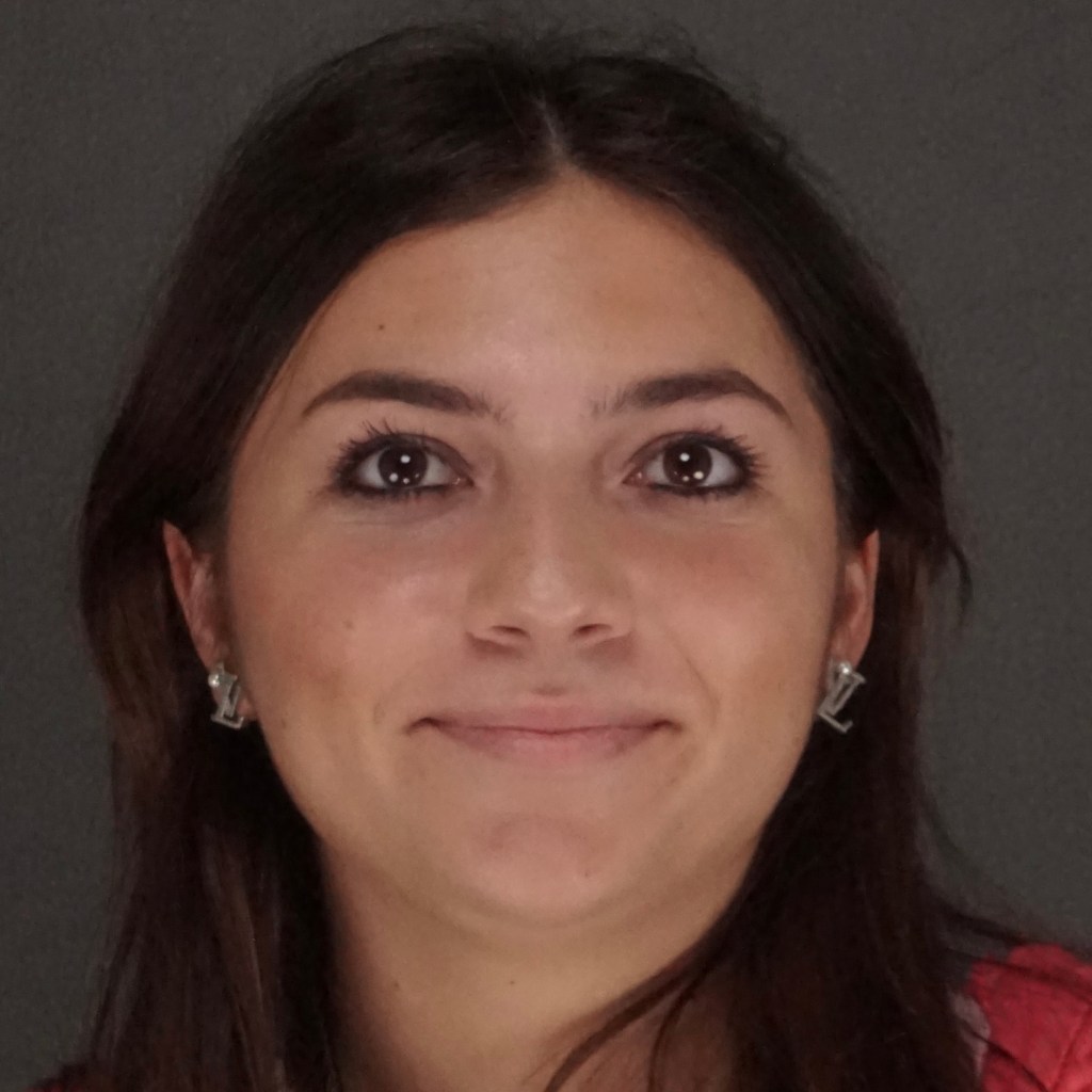 Front view before photo of rhinoplasty patient with nasal dorsum bump prior to nose job surgery by Dr. Elkowitz, Plastic Surgery of New York