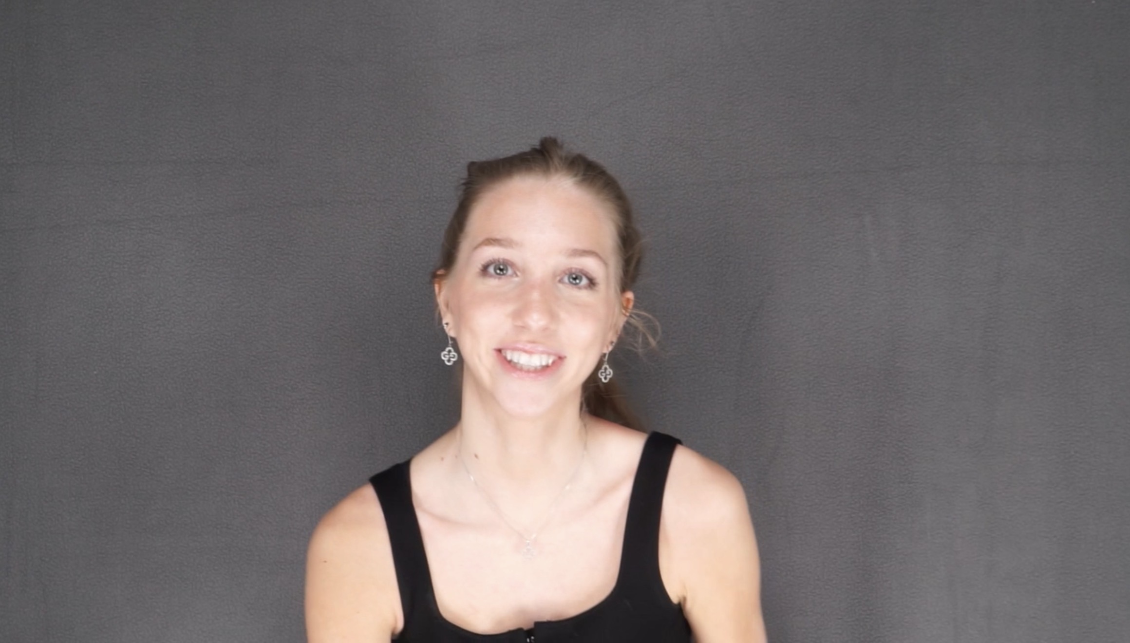 nose job, rhinoplasty, nasal dorsum, bump before and after