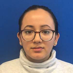 Front view of young woman with both ears after ear pinning surgery, natural and flat – Plastic Surgery of New York