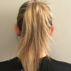Back view of young woman with prominent ears before otoplasty, hair down – Plastic Surgery of New York