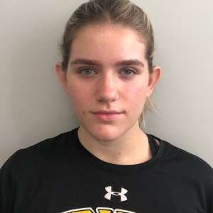 Front view of young woman with prominent ears before otoplasty, hair pulled back – Plastic Surgery of New York