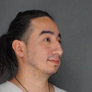 Middle-aged man with dorsal hump rhinoplasty preoperative oblique view plastic Surgery of New York New York City preop