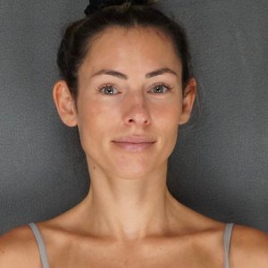 Before and after results – Plastic Surgery of New York