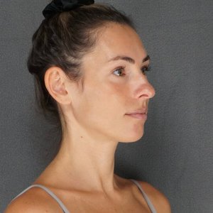 Before and after results – Plastic Surgery of New York